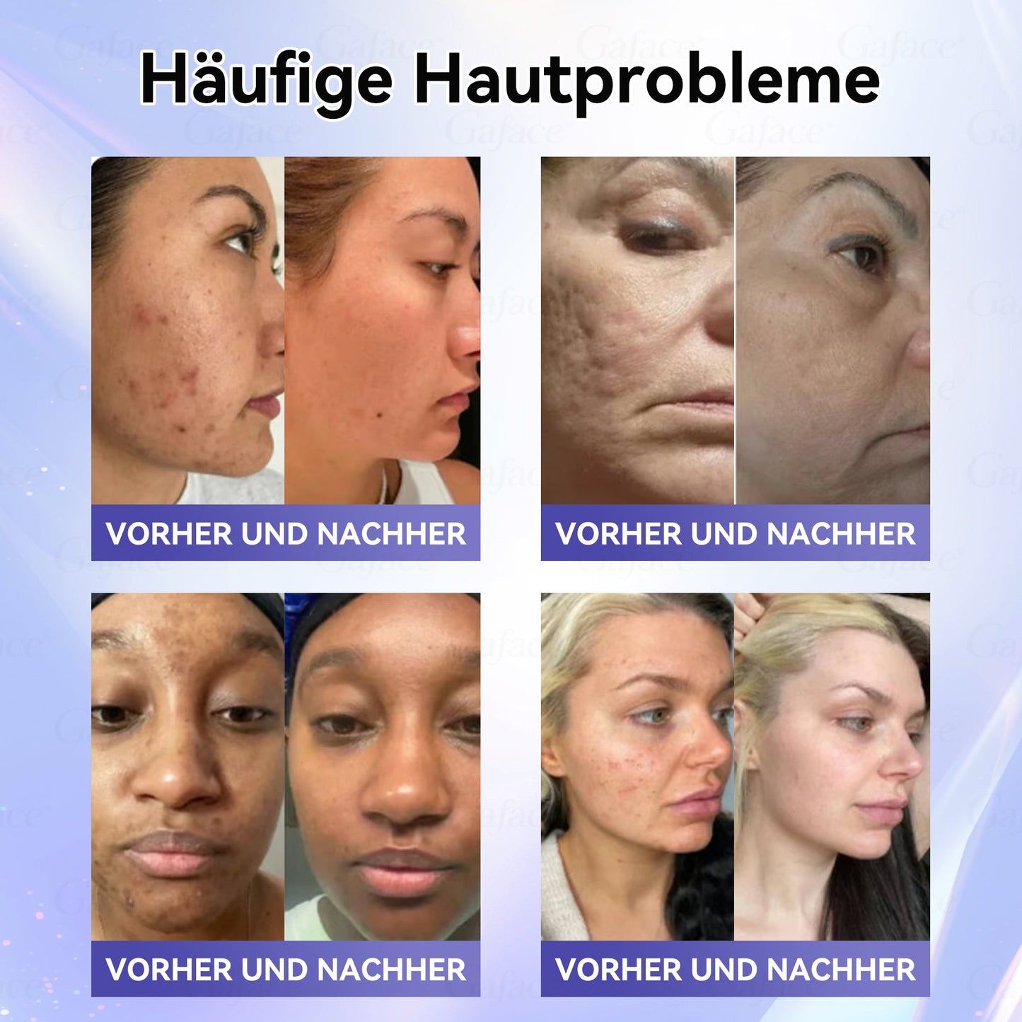 ✨👍𝐆𝐀𝐅𝐀𝐂𝐄® 𝐊𝐨𝐥𝐥𝐚𝐠𝐞𝐧- & 𝐅𝐮𝐥𝐥𝐞𝐫𝐞𝐧-𝐒𝐭𝐫𝐚𝐟𝐟𝐮𝐧𝐠𝐬-𝐑𝐨𝐥𝐥𝐜𝐫𝐞𝐦𝐞 ✨ 𝐊𝐨𝐥𝐥𝐚𝐠𝐞𝐧 & 𝐇𝐲𝐚𝐥𝐮𝐫𝐨𝐧𝐬ä𝐮𝐫𝐞 | 𝐒𝐭𝐫𝐚𝐟𝐟𝐭 𝐬𝐜𝐡𝐥𝐚𝐟𝐟𝐞 𝐇𝐚𝐮𝐭, 𝐫𝐞𝐝𝐮𝐳𝐢𝐞𝐫𝐭 𝐅𝐚𝐥𝐭𝐞𝐧 & 𝐦𝐢𝐧𝐝𝐞𝐫𝐭 𝐝𝐚𝐬 𝐃𝐨𝐩𝐩𝐞𝐥𝐤𝐢𝐧𝐧