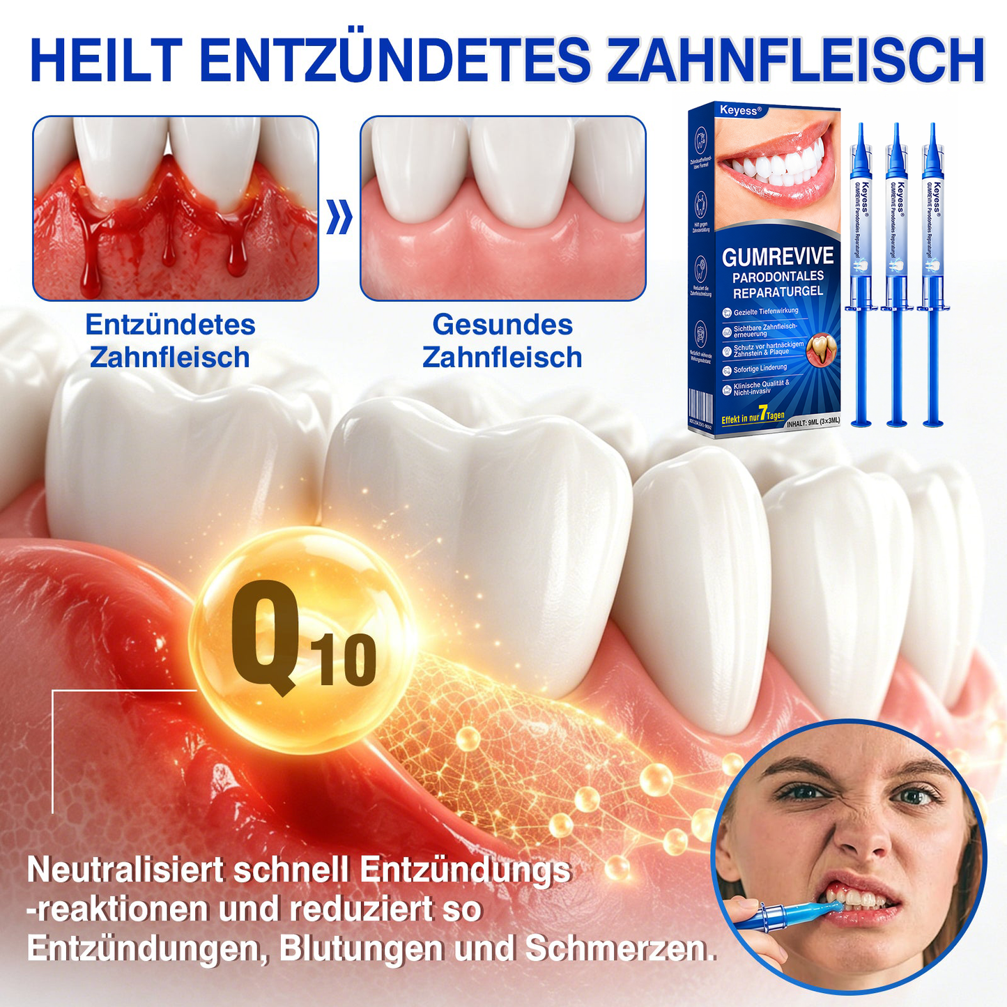 💥𝑲𝒆𝒚𝒆𝒔𝒔®🦷𝑮𝒖𝒎𝑹𝒆𝒗𝒊𝒗𝒆 𝑷𝒂𝒓𝒐𝒅𝒐𝒏𝒕𝒂𝒍𝒆𝒔 𝑹𝒆𝒑𝒂𝒓𝒂𝒕𝒖𝒓𝒈𝒆𝒍