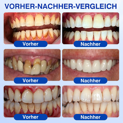 💥𝑲𝒆𝒚𝒆𝒔𝒔®🦷𝑮𝒖𝒎𝑹𝒆𝒗𝒊𝒗𝒆 𝑷𝒂𝒓𝒐𝒅𝒐𝒏𝒕𝒂𝒍𝒆𝒔 𝑹𝒆𝒑𝒂𝒓𝒂𝒕𝒖𝒓𝒈𝒆𝒍