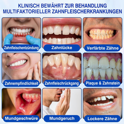 💥𝑲𝒆𝒚𝒆𝒔𝒔®🦷𝑮𝒖𝒎𝑹𝒆𝒗𝒊𝒗𝒆 𝑷𝒂𝒓𝒐𝒅𝒐𝒏𝒕𝒂𝒍𝒆𝒔 𝑹𝒆𝒑𝒂𝒓𝒂𝒕𝒖𝒓𝒈𝒆𝒍
