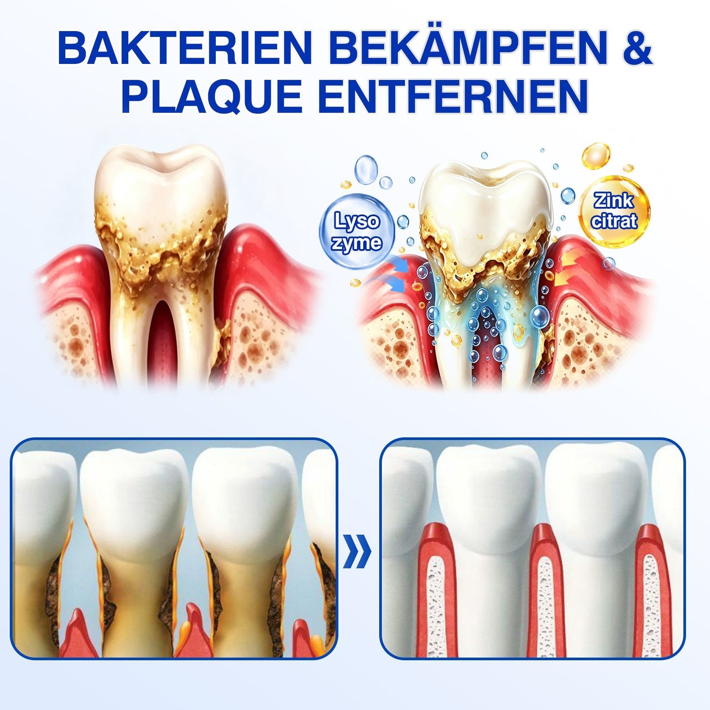 💥𝑲𝒆𝒚𝒆𝒔𝒔®🦷𝑮𝒖𝒎𝑹𝒆𝒗𝒊𝒗𝒆 𝑷𝒂𝒓𝒐𝒅𝒐𝒏𝒕𝒂𝒍𝒆𝒔 𝑹𝒆𝒑𝒂𝒓𝒂𝒕𝒖𝒓𝒈𝒆𝒍