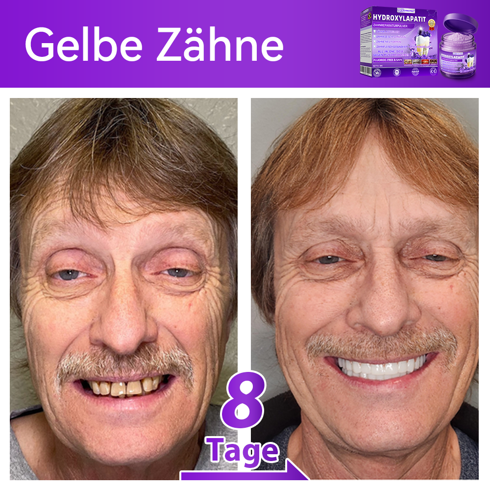 🛡️😁Neujahrs‑Angebot: 80 % RABATT 🎉 Dormorna® Hydroxylapatit‑Zahnreparaturpulver 🦷
