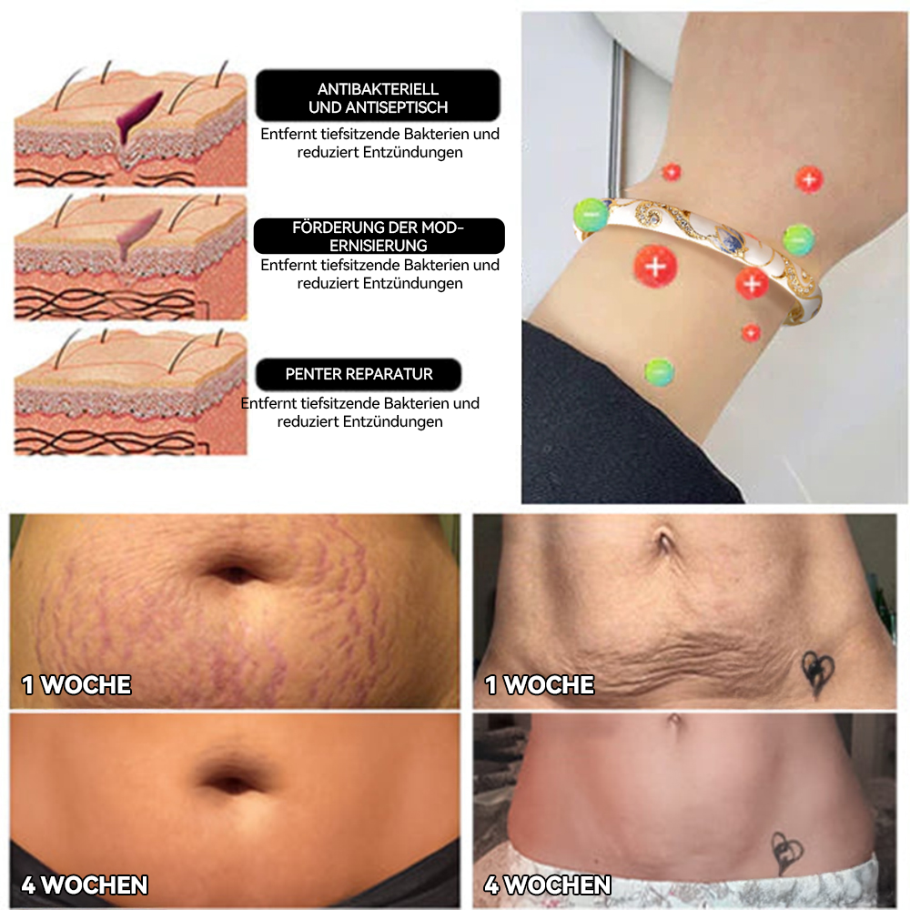 💎𝐂𝐙𝐓𝐈𝐂𝐋𝐄® 𝑪𝒍𝒐𝒊𝒔𝒐𝒏𝒏é 𝑬𝒎𝒂𝒊𝒍𝒍𝒆 👩‍⚕️ 𝑳𝒚𝒎𝒑𝒉𝒂𝒕𝒊𝒔𝒄𝒉𝒆 𝑴𝒂𝒈𝒏𝒆𝒕𝒕𝒉𝒆𝒓𝒂𝒑𝒊𝒆 𝑮𝒐𝒍𝒅𝒂𝒓𝒎𝒃𝒂𝒏𝒅