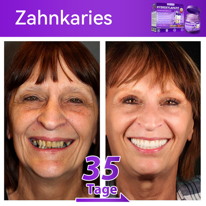 🛡️😁Neujahrs‑Angebot: 80 % RABATT 🎉 Dormorna® Hydroxylapatit‑Zahnreparaturpulver 🦷