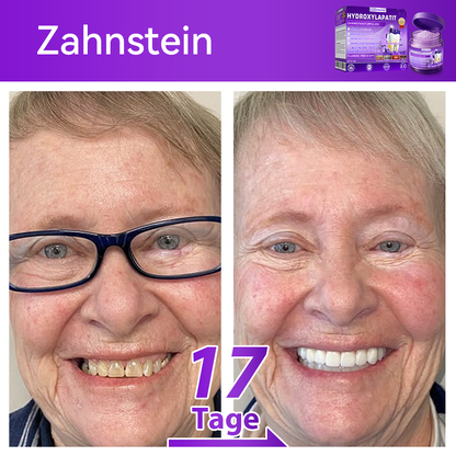 🛡️😁Neujahrs‑Angebot: 80 % RABATT 🎉 Dormorna® Hydroxylapatit‑Zahnreparaturpulver 🦷