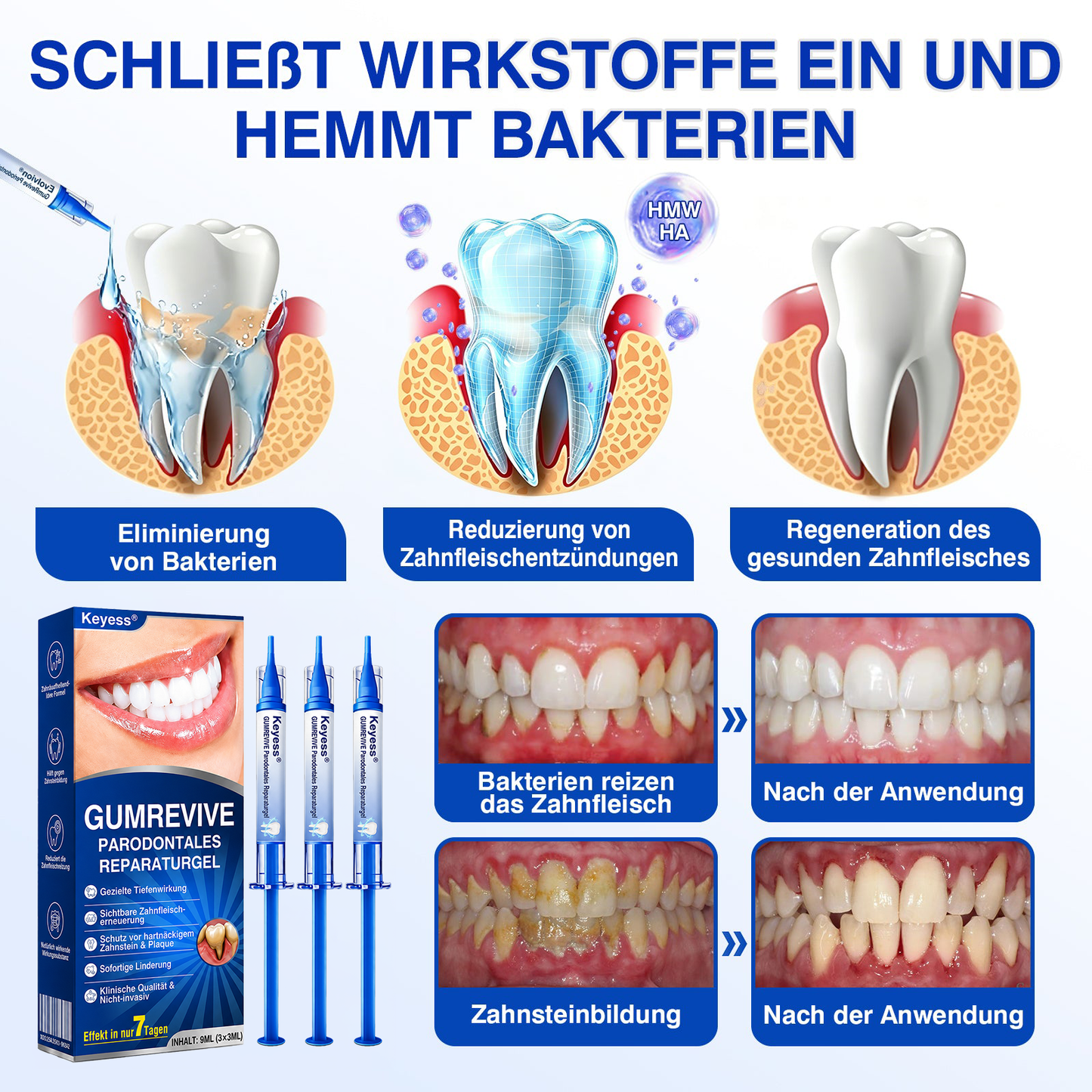 💥𝑲𝒆𝒚𝒆𝒔𝒔®🦷𝑮𝒖𝒎𝑹𝒆𝒗𝒊𝒗𝒆 𝑷𝒂𝒓𝒐𝒅𝒐𝒏𝒕𝒂𝒍𝒆𝒔 𝑹𝒆𝒑𝒂𝒓𝒂𝒕𝒖𝒓𝒈𝒆𝒍