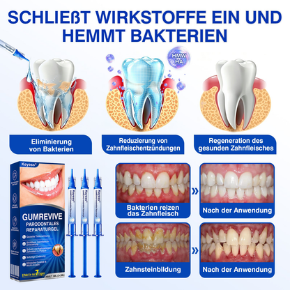 💥𝑲𝒆𝒚𝒆𝒔𝒔®🦷𝑮𝒖𝒎𝑹𝒆𝒗𝒊𝒗𝒆 𝑷𝒂𝒓𝒐𝒅𝒐𝒏𝒕𝒂𝒍𝒆𝒔 𝑹𝒆𝒑𝒂𝒓𝒂𝒕𝒖𝒓𝒈𝒆𝒍