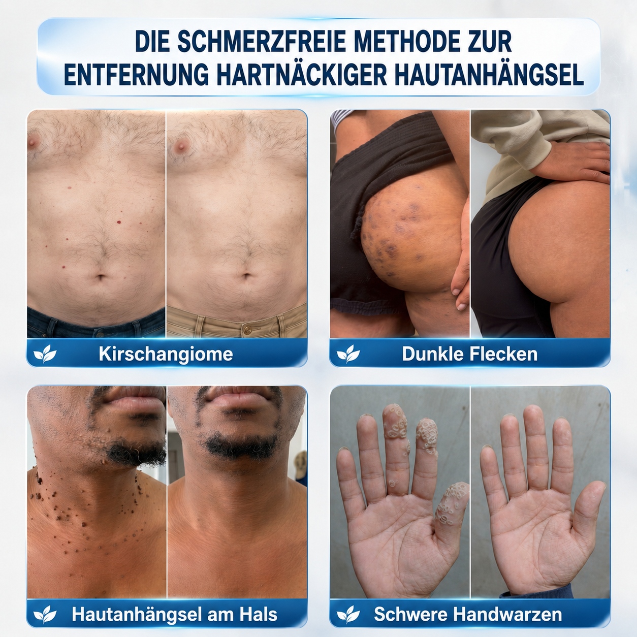 👩‍⚕️🎉𝑶𝒇𝒇𝒊𝒛𝒊𝒆𝒍𝒍𝒆𝒓 𝑺𝒕𝒐𝒓𝒆 | 𝑵𝐞𝒌𝐢𝐬𝐬® 🌿 𝑴𝒊𝒌𝒓𝒐𝒏𝒂𝒅𝒆𝒍𝒏 𝑴𝒂𝒌𝒆𝒍𝒍𝒐𝒔𝒆 𝑯𝒂𝒖𝒕 𝑯𝒂𝒖𝒕 𝑾𝒂𝒓𝒛𝒆 𝑬𝒏𝒕𝒇𝒆𝒓𝒏𝒖𝒏𝒈 𝑷𝒇𝒍𝒂𝒔𝒕𝒆𝒓 (𝐹ü𝑟 𝐻𝑎𝑢𝑡𝑎𝑛ℎä𝑛𝑔𝑠𝑒𝑙, 𝑘𝑙𝑒𝑖𝑛𝑒 𝐻𝑎𝑢𝑡𝑤𝑢𝑐ℎ𝑒𝑟𝑢𝑛𝑔𝑒𝑛, 𝑊𝑎𝑟𝑧𝑒𝑛, 𝑀𝑢𝑡𝑡𝑒𝑟𝑚𝑎𝑙𝑒, 𝐴𝑙𝑡𝑒𝑟𝑠𝑓𝑙𝑒𝑐𝑘𝑒𝑛 𝑢𝑛𝑑 𝑃𝑖𝑔𝑚𝑒𝑛𝑡𝑠𝑡ö𝑟𝑢𝑛𝑔𝑒𝑛.)