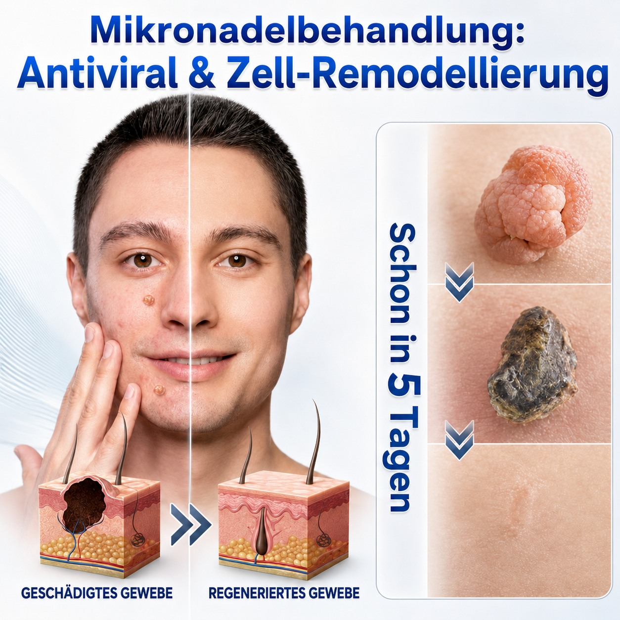 👩‍⚕️🎉𝑶𝒇𝒇𝒊𝒛𝒊𝒆𝒍𝒍𝒆𝒓 𝑺𝒕𝒐𝒓𝒆 | 𝑵𝐞𝒌𝐢𝐬𝐬® 🌿 𝑴𝒊𝒌𝒓𝒐𝒏𝒂𝒅𝒆𝒍𝒏 𝑴𝒂𝒌𝒆𝒍𝒍𝒐𝒔𝒆 𝑯𝒂𝒖𝒕 𝑯𝒂𝒖𝒕 𝑾𝒂𝒓𝒛𝒆 𝑬𝒏𝒕𝒇𝒆𝒓𝒏𝒖𝒏𝒈 𝑷𝒇𝒍𝒂𝒔𝒕𝒆𝒓 (𝐹ü𝑟 𝐻𝑎𝑢𝑡𝑎𝑛ℎä𝑛𝑔𝑠𝑒𝑙, 𝑘𝑙𝑒𝑖𝑛𝑒 𝐻𝑎𝑢𝑡𝑤𝑢𝑐ℎ𝑒𝑟𝑢𝑛𝑔𝑒𝑛, 𝑊𝑎𝑟𝑧𝑒𝑛, 𝑀𝑢𝑡𝑡𝑒𝑟𝑚𝑎𝑙𝑒, 𝐴𝑙𝑡𝑒𝑟𝑠𝑓𝑙𝑒𝑐𝑘𝑒𝑛 𝑢𝑛𝑑 𝑃𝑖𝑔𝑚𝑒𝑛𝑡𝑠𝑡ö𝑟𝑢𝑛𝑔𝑒𝑛.)
