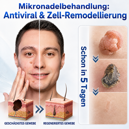 👩‍⚕️🎉𝑶𝒇𝒇𝒊𝒛𝒊𝒆𝒍𝒍𝒆𝒓 𝑺𝒕𝒐𝒓𝒆 | 𝑵𝐞𝒌𝐢𝐬𝐬® 🌿 𝑴𝒊𝒌𝒓𝒐𝒏𝒂𝒅𝒆𝒍𝒏 𝑴𝒂𝒌𝒆𝒍𝒍𝒐𝒔𝒆 𝑯𝒂𝒖𝒕 𝑯𝒂𝒖𝒕 𝑾𝒂𝒓𝒛𝒆 𝑬𝒏𝒕𝒇𝒆𝒓𝒏𝒖𝒏𝒈 𝑷𝒇𝒍𝒂𝒔𝒕𝒆𝒓 (𝐹ü𝑟 𝐻𝑎𝑢𝑡𝑎𝑛ℎä𝑛𝑔𝑠𝑒𝑙, 𝑘𝑙𝑒𝑖𝑛𝑒 𝐻𝑎𝑢𝑡𝑤𝑢𝑐ℎ𝑒𝑟𝑢𝑛𝑔𝑒𝑛, 𝑊𝑎𝑟𝑧𝑒𝑛, 𝑀𝑢𝑡𝑡𝑒𝑟𝑚𝑎𝑙𝑒, 𝐴𝑙𝑡𝑒𝑟𝑠𝑓𝑙𝑒𝑐𝑘𝑒𝑛 𝑢𝑛𝑑 𝑃𝑖𝑔𝑚𝑒𝑛𝑡𝑠𝑡ö𝑟𝑢𝑛𝑔𝑒𝑛.)