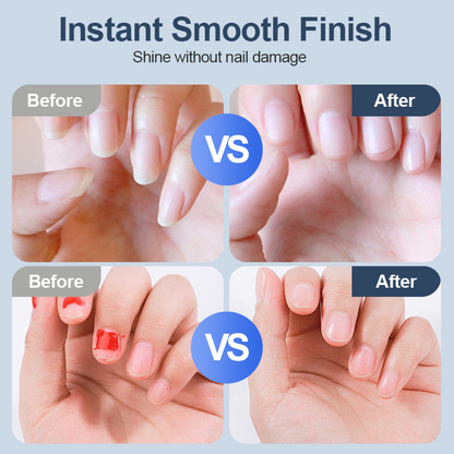 💕💕💕Universeller automatischer Nageltrimmer – 6 Geschwindigkeitsstufen, ausgestattet mit 5 Aufsätzen, sicher und sanft für die Nagelpflege 💅✨